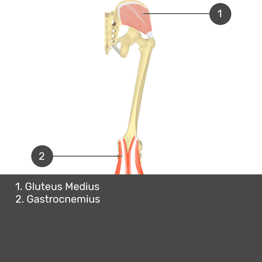 Test yourself image 12, posterior view of thigh and gluteal region. Muscles and structures labelled- gluteus medius, gastrocnemius.