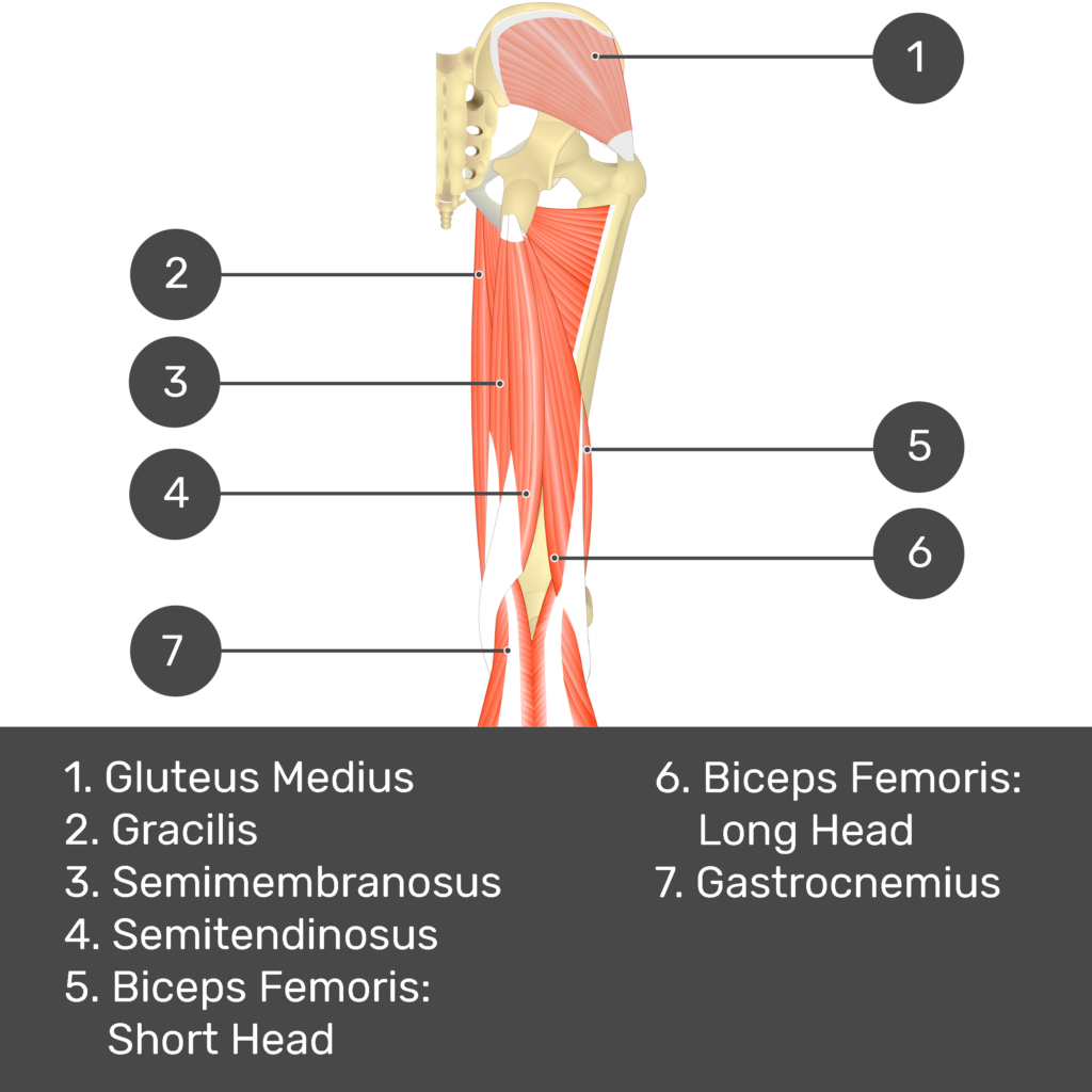 Test yourself image 6, posterior view of thigh and gluteal region. Muscles and structures labelled- gluteus medius, gracilis, semimembranosus, semitendinosus, biceps femoris: short head, biceps femoris: long head, gastrocnemius.