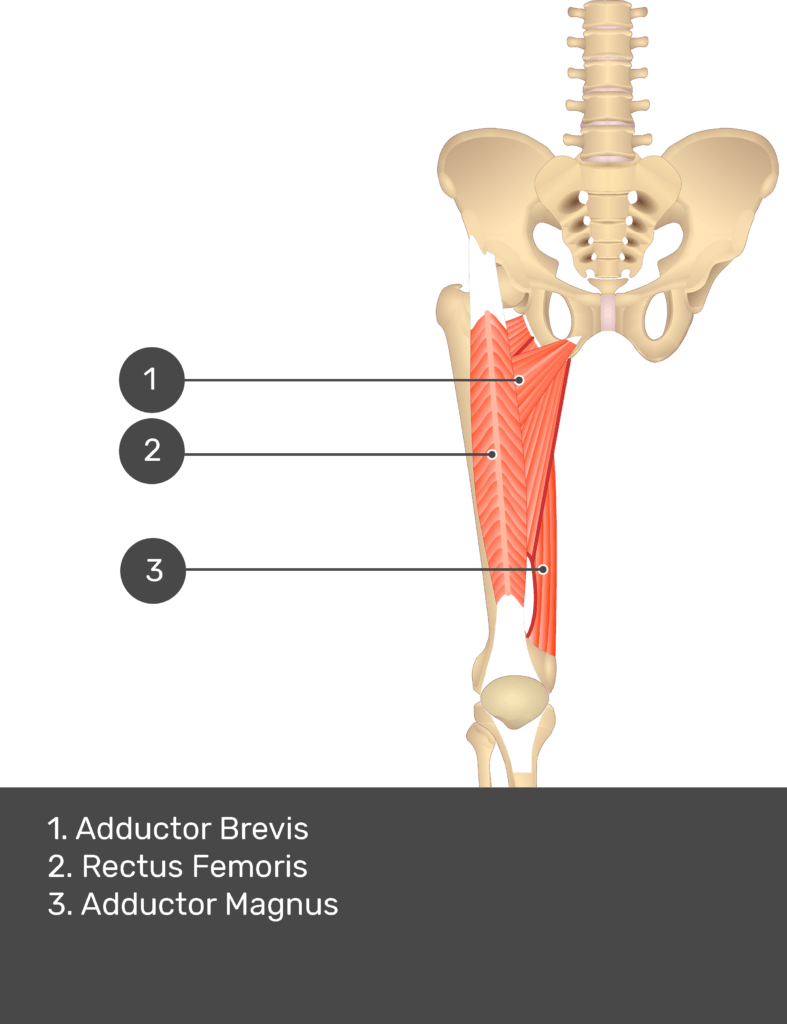 A quiz image of the anterior view of the thigh, pelvis and lower section of the vertebral column. The muscles of the anterior thigh are numbered 1 to 3. The answers revealed at the bottom are as follows 1. Adductor Brevis 2. Rectus Femoris 3. Adductor Magnus.