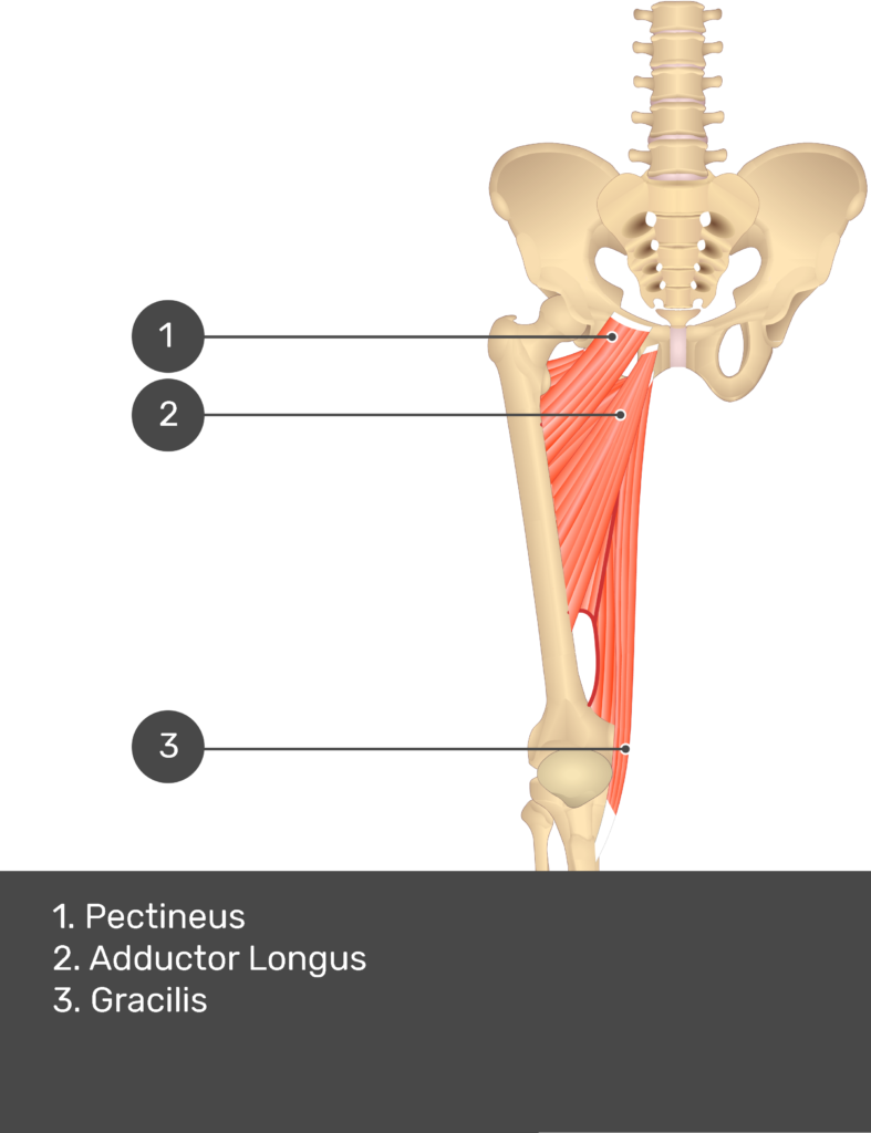 A quiz image of the anterior view of the thigh, pelvis and lower section of the vertebral column. The muscles of the anterior thigh are numbered 1 to 3. The answers revealed at the bottom are as follows 1. Pectineus 2. Adductor Longus 3. Gracilis.