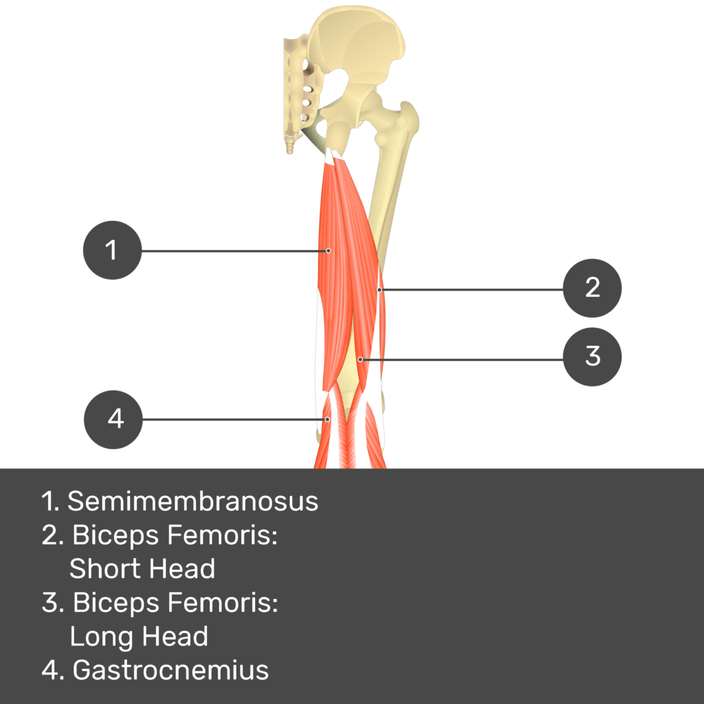 Test yourself image 11, posterior view of thigh and gluteal region. Muscles and structures labelled- semimembranosus, biceps femoris: short head, biceps femoris: long head, gastrocnemius.