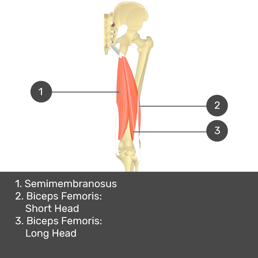 Test yourself image 12, posterior view of thigh and gluteal region. Muscles and structures labelled- semimembranosus, biceps femoris: short head, biceps femoris: long head.