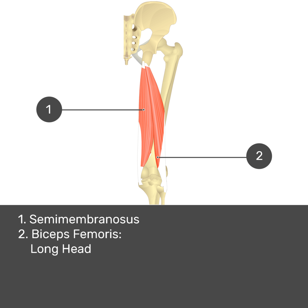 Test yourself image 13, posterior view of thigh and gluteal region. Muscles and structures labelled- semimembranosus, biceps femoris: long head.