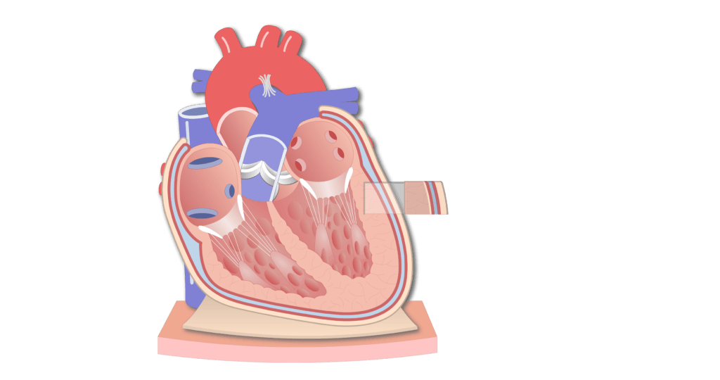 Coronal section of the pericardium animation slide 5