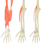 Featured image showing three images of the posterior forearm. The image on the left shows the bony elements and the muscles of the posterior forearm, the middle image shows the bony elements and isolated Extensor Carpi Radialis Longus muscle, and the image on the right shows the attachments of the Extensor Carpi Radialis Longus muscle connected by a transparent muscle itself.