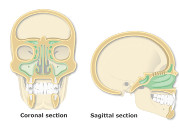 Featured Image Paranasal Sinuses on Coronal and Sagittal View