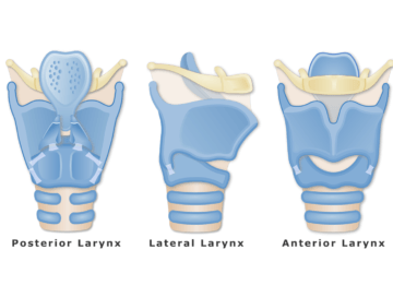 The cartilages of the larynx are shown in anterior, lateral and posterior view