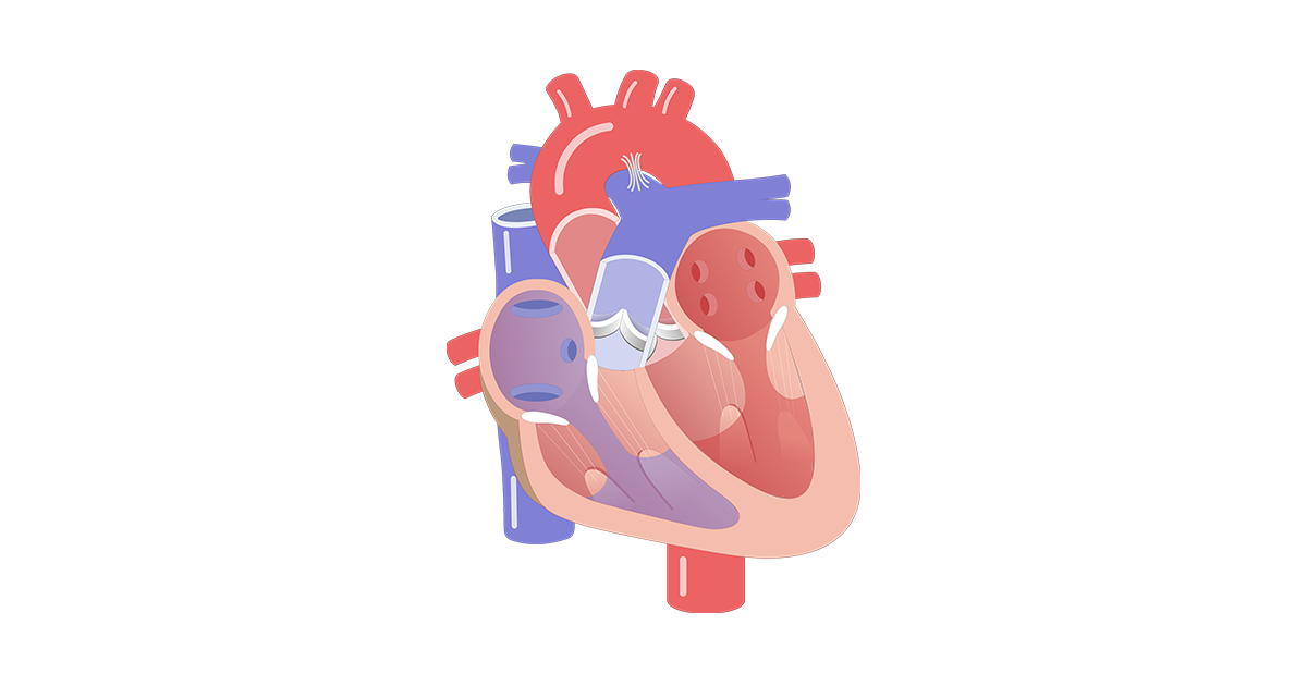 Heart Valve Movement | GetBodySmart