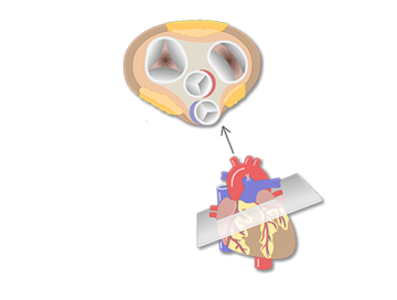 Featured image of the valves of the heart