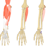 Featured image showing three images of the anterior forearm. The image on the left shows the bony elements and the muscles of the anterior forearm, the middle image shows the bony elements and isolated Flexor Carpi Ulnaris muscle, and the image on the right shows the attachments of the Flexor Carpi Ulnaris muscle connected by a transparent muscle itself.