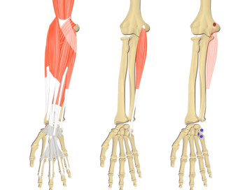 Featured image showing three images of the anterior forearm. The image on the left shows the bony elements and the muscles of the anterior forearm, the middle image shows the bony elements and isolated Flexor Carpi Ulnaris muscle, and the image on the right shows the attachments of the Flexor Carpi Ulnaris muscle connected by a transparent muscle itself.