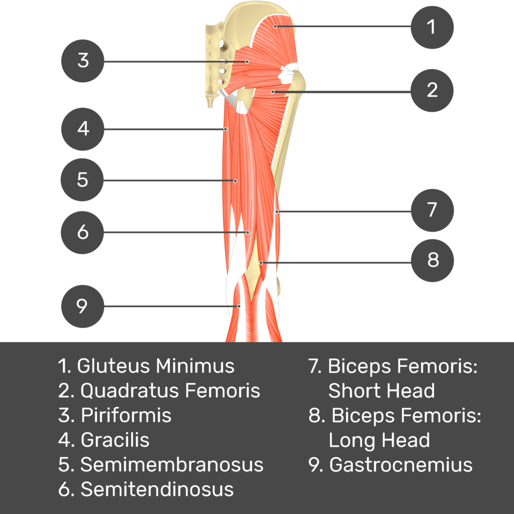 Test yourself image 7, posterior view of thigh and gluteal region, lateral rotators of the thigh visible. Muscles and structures labelled- gluteus minimus, piriformis, quadratus femoris, gracilis, semimembranosus, semitendinosus, biceps femoris: short head, biceps femoris: long head, gastrocnemius.