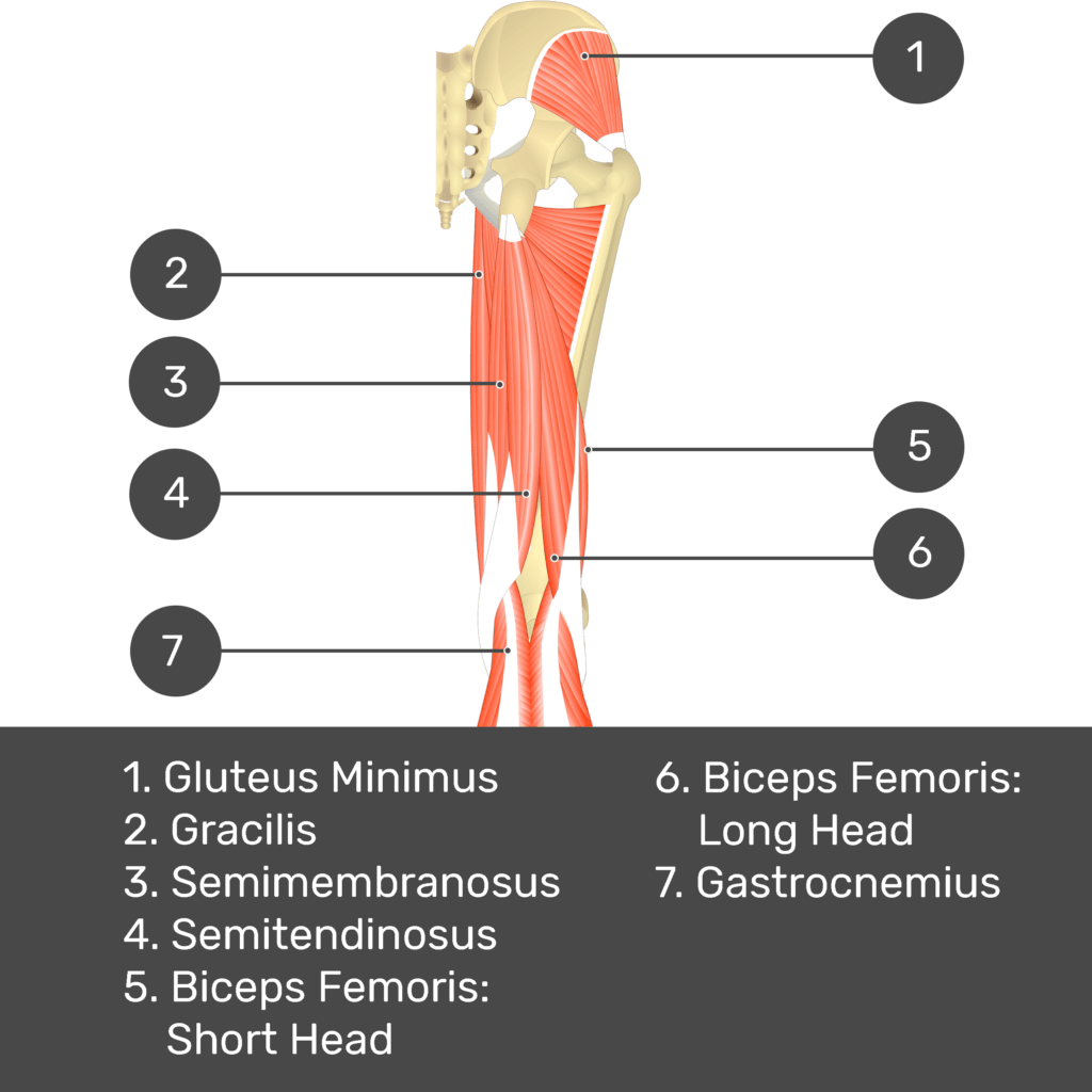 Test yourself image 8, posterior view of thigh and gluteal region. Muscles and structures labelled- gluteus minimus, gracilis, semimembranosus, semitendinosus, biceps femoris: short head, biceps femoris: long head, gastrocnemius.