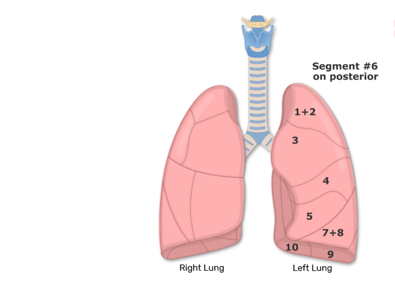 Bronchopulmonary Segments of the Lungs | Lung Segments | Tertiary Bronchi