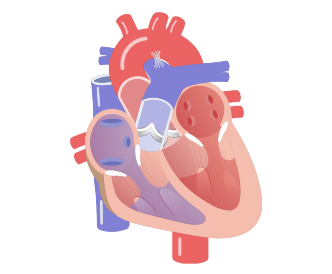 cardiac cycle of heart video session hipertónia kezelése