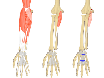 Featured image showing three images of the anterior forearm. The image on the left shows the bony elements and the muscles of the anterior forearm, the middle image shows the bony elements and isolated Palmaris Longus muscle, and the image on the right shows the attachments of the Palmaris Longus muscle connected by a transparent muscle itself.