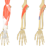 Featured image showing 3 images of the anterior forearm bony muscles and associated structures. The image on the left shows all forearm muscles, middle image shows isolated Pronator Teres muscle and right image shows the attachments of the two heads of Pronator Teres.