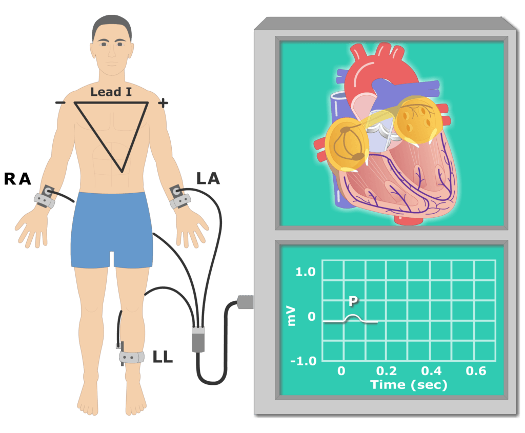 QRS wave EKG recording animationn slide 1