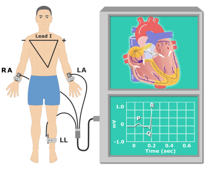The Electrocardiogram (EKG or ECG) | GetBodySmart