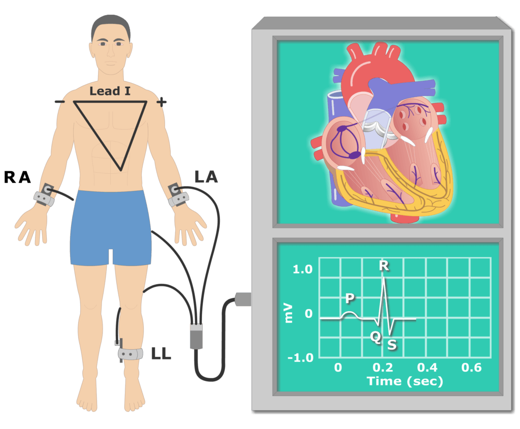 QRS wave EKG recording animationn slide 4