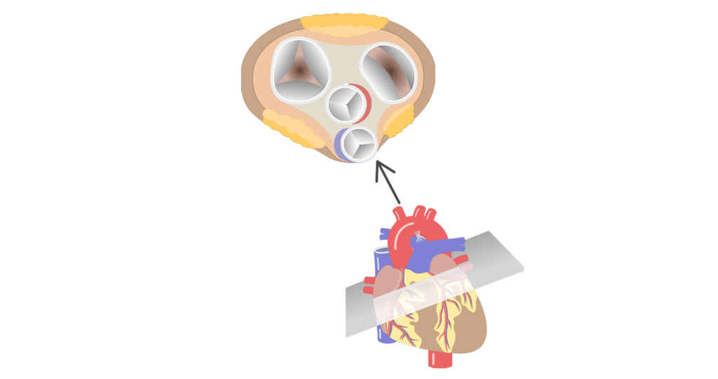 Heart Valve Diagram Unlabeled