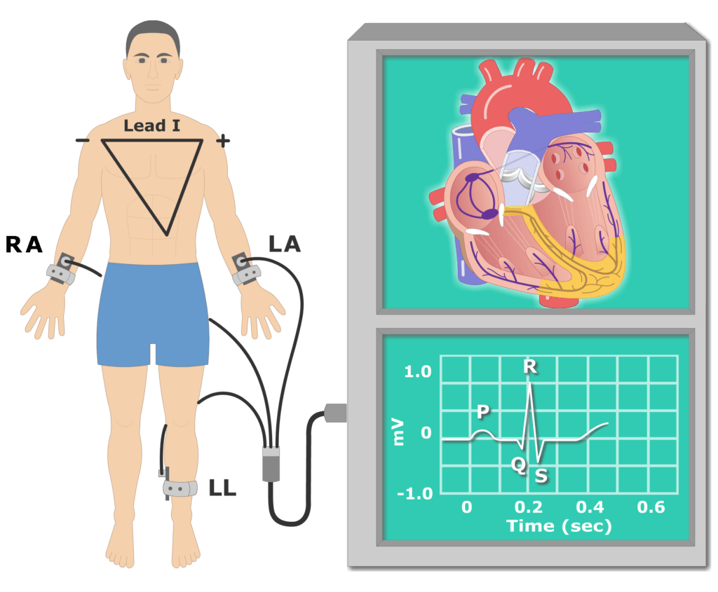 T wave EKG recording animation slide 2