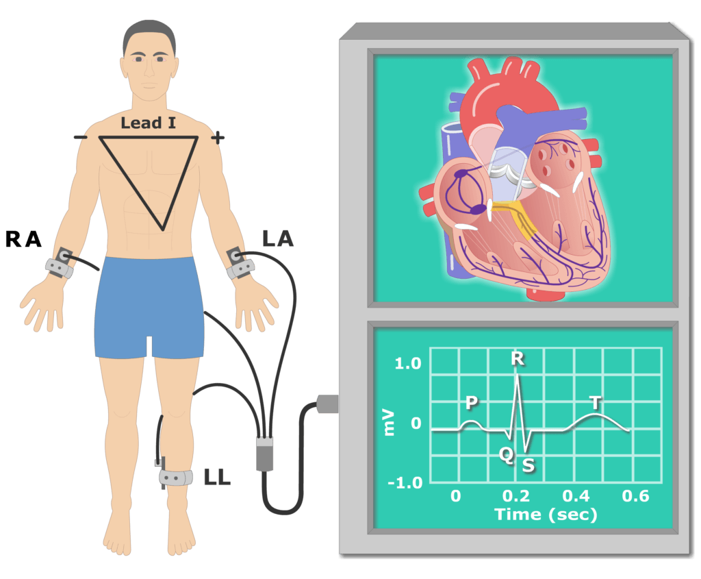 T wave EKG recording animation slide 3