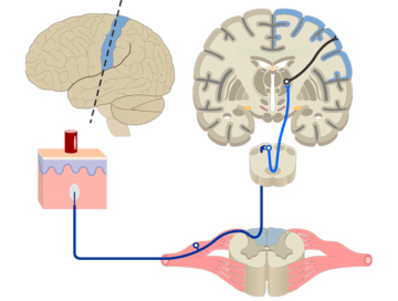 The neuronal connection from the sensory corpuscles of the skin to the spinal cord and the brain.