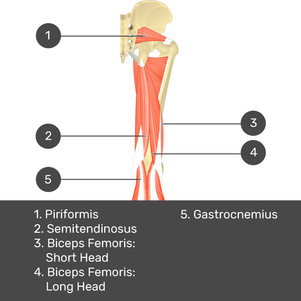 Test yourself image 11, posterior view of thigh and gluteal region. Muscles labelled- piriformis, gracilis, semitendinosus, biceps femoris: short head, biceps femoris: long head, gastrocnemius.