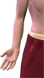 Slide 5 of radial deviation (abduction) at the wrist.