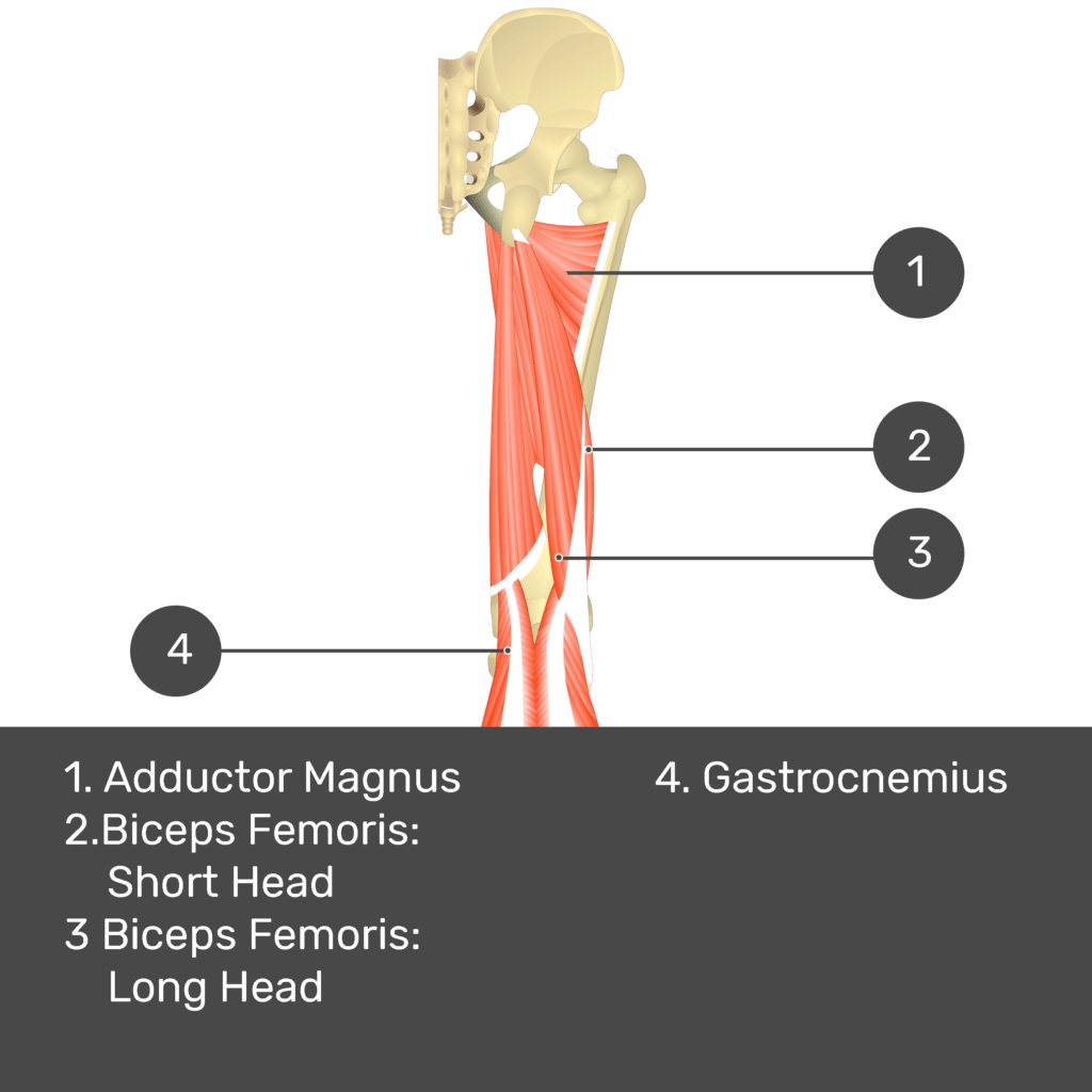 Test yourself image 12, posterior view of thigh and gluteal region. Muscles and structures labelled- adductor magnus, biceps femoris: short head, biceps femoris: long head, gastrocnemius.