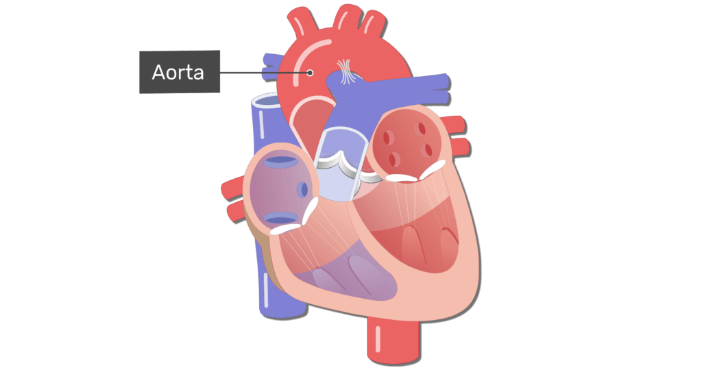 Coronal view of the heart with the aorta labelled