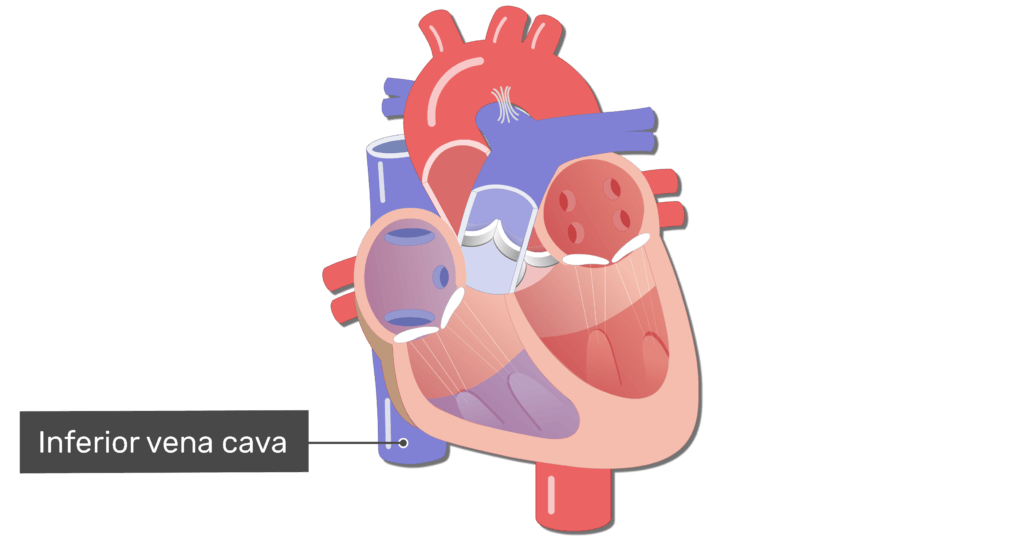 Coronal view of the heart with the inferior vena cava labelled