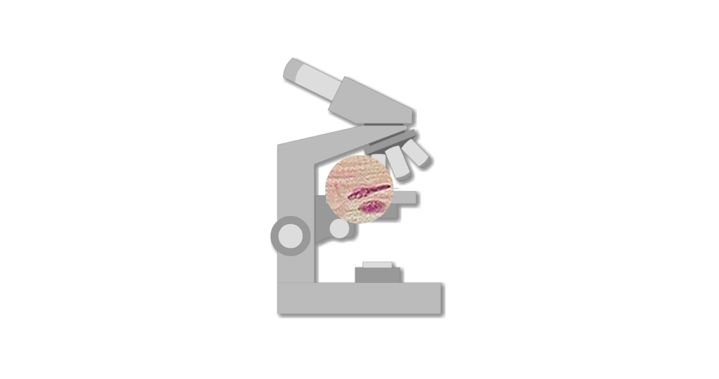 Micrograph of cardiac muscle cells animation slide 3