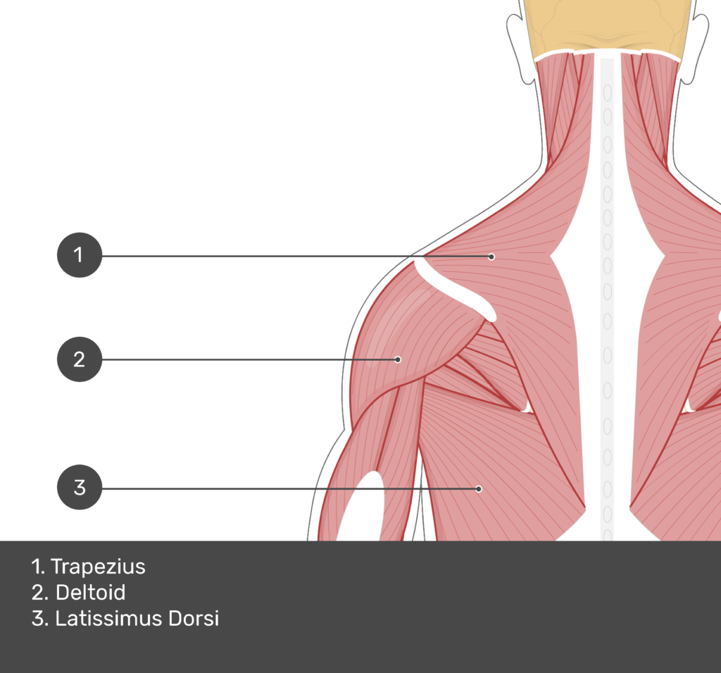 A quiz image of the posterior view of the occipital region of the skull, cervical and thoracic regions of the spinal column, upper arm, scapulae and the most superficial muscle layer. The muscles of the back and neck are labelled 1-3. The answers at the bottom are as follows 1. Trapezius 2. Deltoid 3. Latissimus Dorsi.