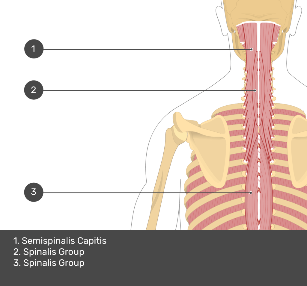 A quiz image of the posterior view of the occipital region of the skull, cervical and thoracic regions of the spinal column, upper arm, scapulae and the deeper muscle layer. The muscles of the back and neck are labelled 1-3. The answers at the bottom are as follows 1. Semispinalis Capitis 2. Spinalis Group 3. Spinalis Group.