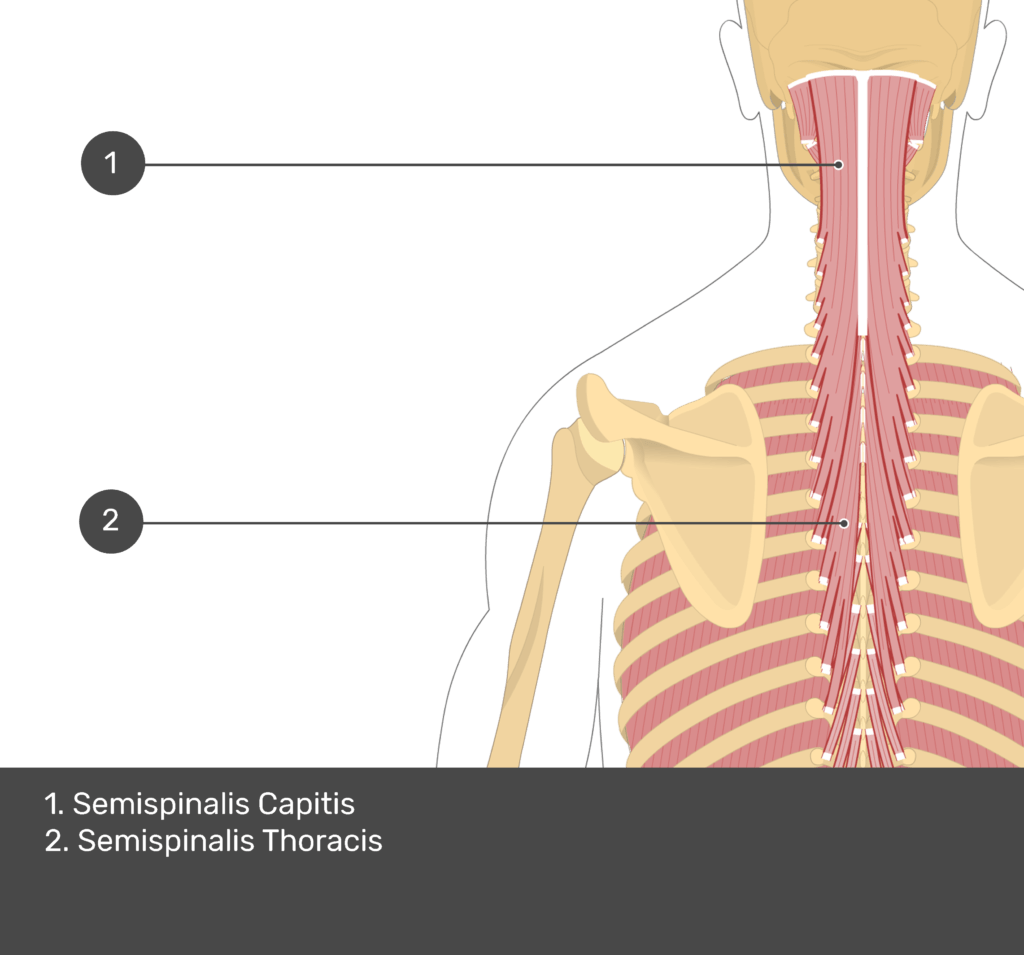 A quiz image of the posterior view of the occipital region of the skull, cervical and thoracic regions of the spinal column, upper arm, scapulae and the deeper muscle layer. The muscles of the back and neck are labelled 1-2. The answers at the bottom are as follows 1. Semispinalis Capitis 2. Semispinalis Thoracis.