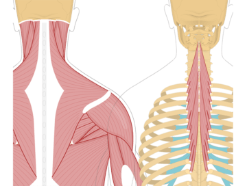 Featured image showing two views of the posterior view of the occipital region of the skull, cervical and thoracic regions of the spinal column, upper arm and scapulae. The image on the left shows the bony elements and the muscles of the back and next, the image on the right shows isolated Semispinalis Thoracis Muscle.