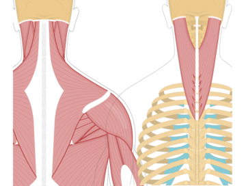A quiz image of the posterior view of the occipital region of the skull, cervical and thoracic regions of the spinal column, upper arm and scapulae showing the origin of Semispinalis Cervicis at the inferior half of ligamentum nuchae (C3-C6) and spinous processes of C7-T3 (possibly down to T6) marked by a red circles and insertion at superior nuchal line of occipital bone and mastoid process of temporal bone marked by a blue line.