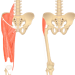 Featured image showing two views on the anterior thigh. The image on the left shows the bony elements and the muscles of the anterior thigh, the image on the right shows the bony elements and the isolated Tensor Fasciae Latae muscle.