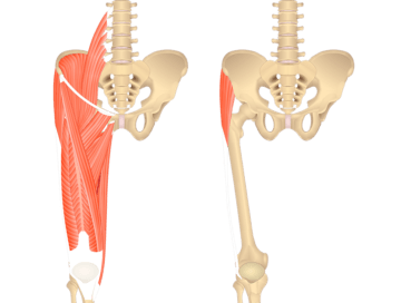 Featured image showing two views on the anterior thigh. The image on the left shows the bony elements and the muscles of the anterior thigh, the image on the right shows the bony elements and the isolated Tensor Fasciae Latae muscle.