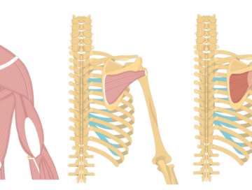 Feature image containing three images of the posterior view of the back and arm showing infraspinatus.
