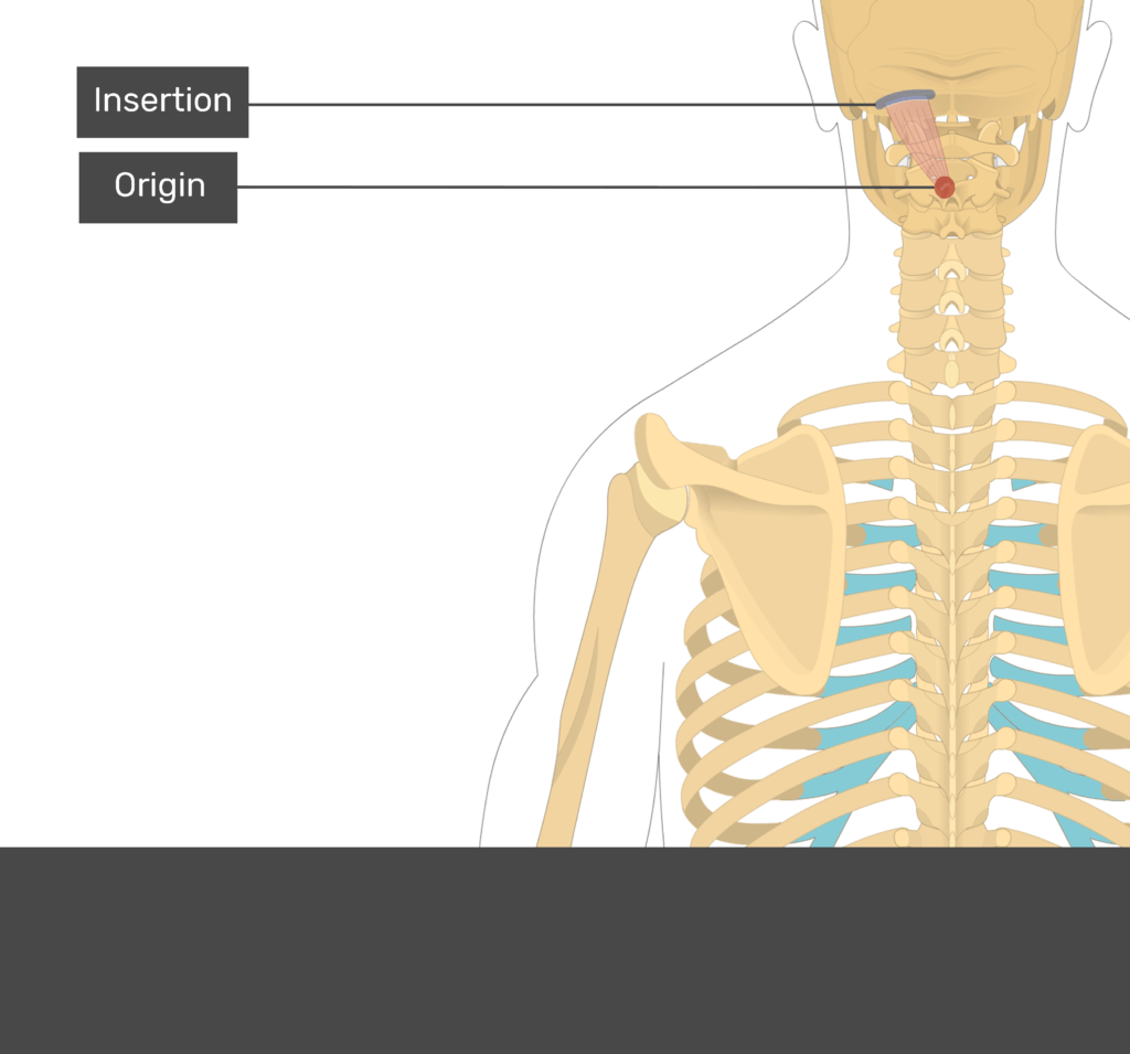 A quiz image of the posterior view of the occipital region of the skull, cervical and thoracic regions of the spinal column, upper arm and scapulae showing the origin of Rectus Capitis Posterior Major at the spinous process of the axis vertebra (C2) marked by a red circle and insertion at the lateral portion of inferior nuchal line of occipital bone is marked by a blue line.