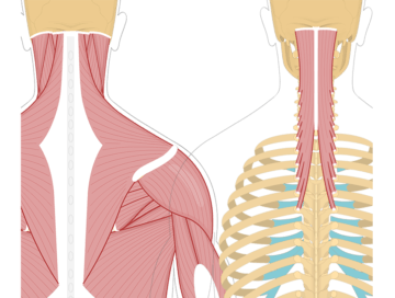 Featured image showing two views of the posterior view of the occipital region of the skull, cervical and thoracic regions of the spinal column, upper arm and scapulae. The image on the left shows the bony elements and the muscles of the back and next, the image on the right shows isolated Semispinalis Capitis Muscle.