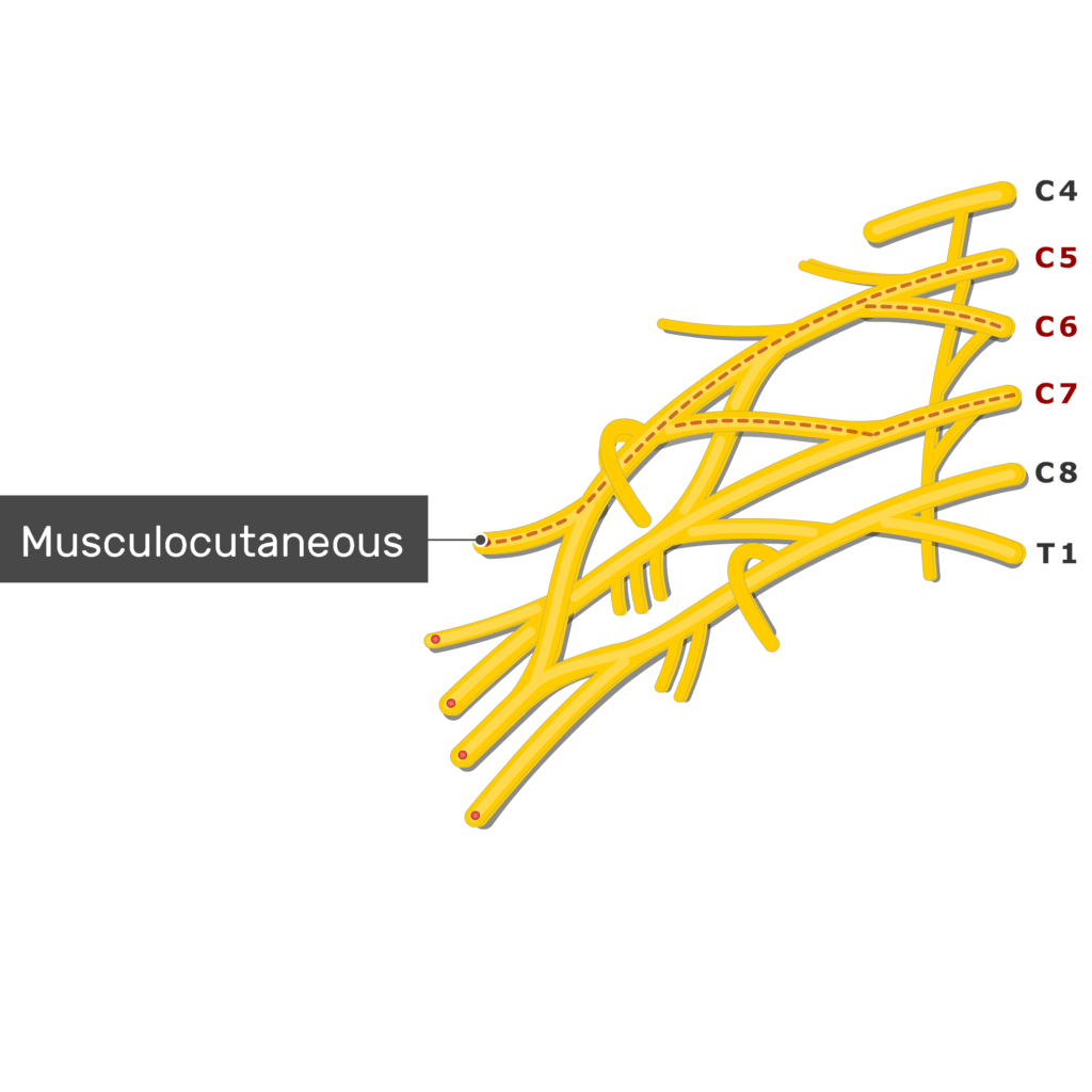 An image showing the Musculocutaneous nerve coming out of the brachial plexus