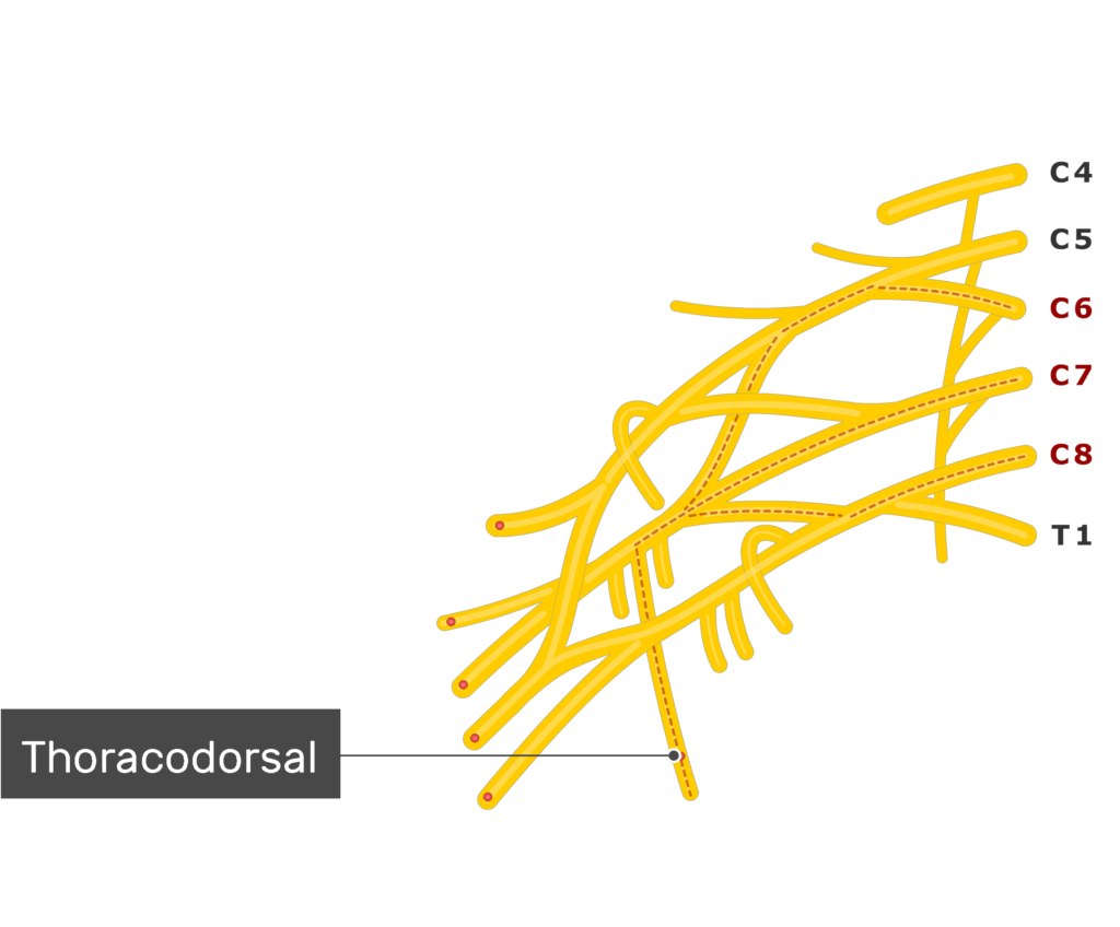 An image showing the Thoracodorsal nerve coming out of the brachial plexus