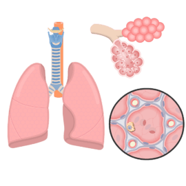 Respiratory system (lungs, bronchi, trachea) on the left side, alveoli and their cellular components on the right side