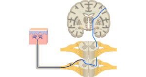 Three sensory neurons transmitting the sensation from the skin through the spinal cord ending in the sensory cortex