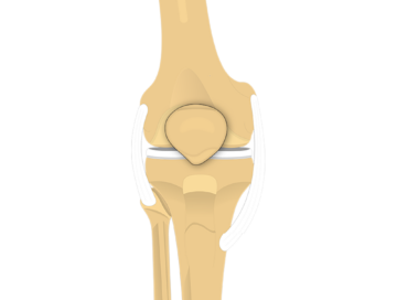 Patella (anterior view)